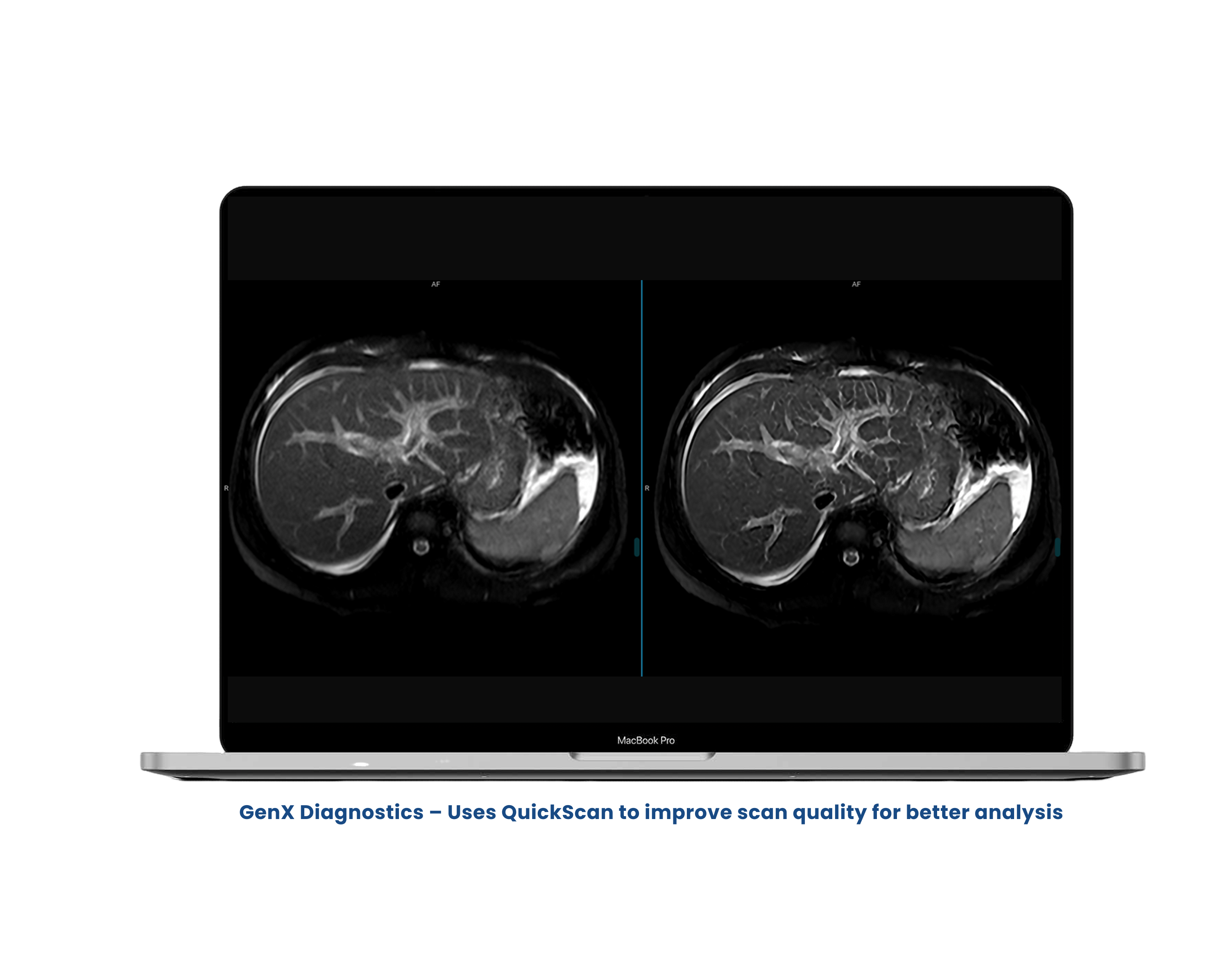 Aiken QuickFlow Dashboard